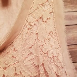 Scalloped lace top